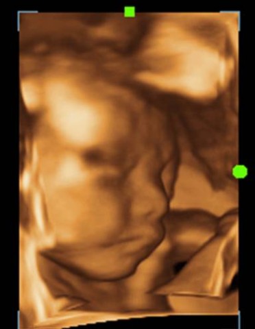 Ультразвуковой аппарат Mindray DC-7 - 2 364 300 руб.