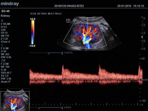 Аппарат ультразвуковой диагностический DC-40 - 392 100 руб.
