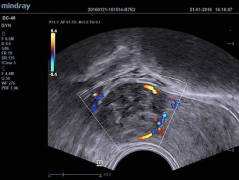 Аппарат ультразвуковой диагностический DC-40 - 392 100 руб.