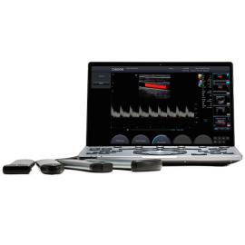УЗИ аппарат Chison SonoAir 60