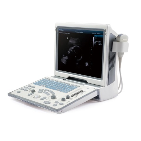 УЗИ аппарат Mindray DP-50 - 227 400 руб.