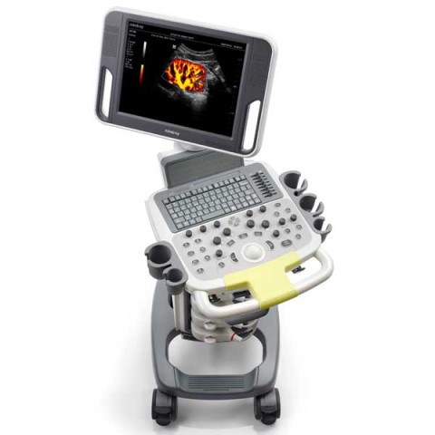 УЗИ сканер Mindray DC-N3 - 313 700 руб.