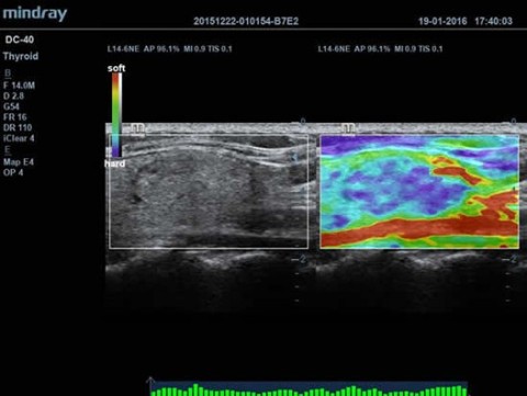 Аппарат ультразвуковой диагностический DC-40 - 384 400 руб.