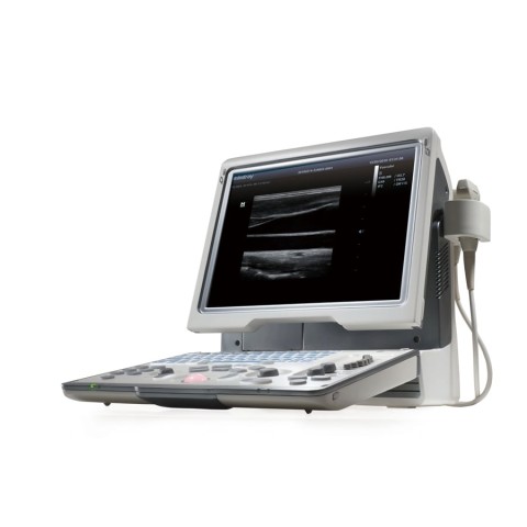 УЗИ аппарат Mindray DP-50 Color - 349 000 руб.